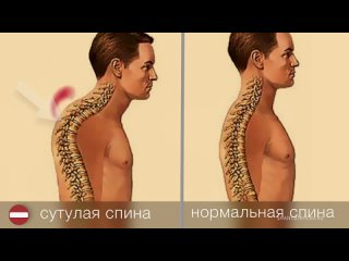 [yoga and meditation] how to correct shoulder. back exercises. muscle corset for posture